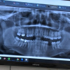 Radiografía en una clínica dental.